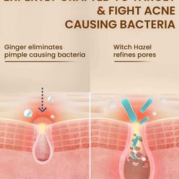 THE SKIN STORY Ginger & Cinnamon Face Wash with Witch Hazel - 100ml image 4