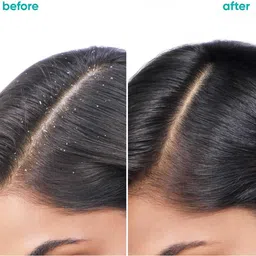 Biolage Scalppure Anti-Dandruff Shampoo + Conditioner For Scalp with Dandruff image 5