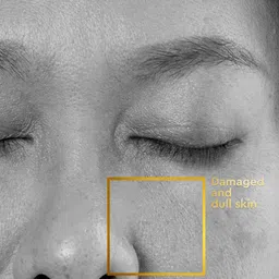 VLCC Clinic ProRescue Micro Serum Powered by 5XCellRescue Complex With Marine Algae-30 ml image 4