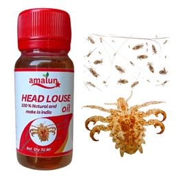 Amalun Lice Removal Oil - Fast-Acting Solution for Head Lice and Scalp Care" image 1