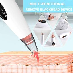 quiqshipp 6 in 1 Multi-function Blackhead Remover Tools | Electric Derma suction Machine | USB Rechargeable Acne Pimple Pore Cleaner Vacuum tool - Facial Cleanser Device for Nose & Skin Care (White) image 3