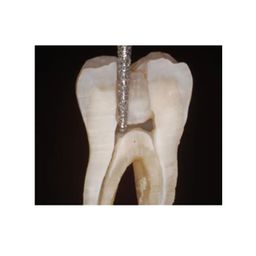 SuperEndo Endo Access Bur (14) | Precision Dental Bur for Efficient Access Cavity Preparation | Durable Tungsten Carbide Material for Smooth Cutting | Ideal for Root Canal and Endodontic Procedures. image 5