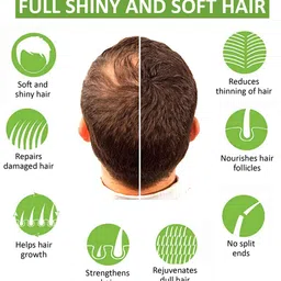 7 DAYS Green Apple Shampoo For Dandruff - 200ml image 4