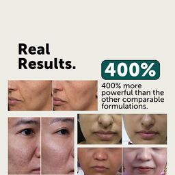 LAURITZ 3% Coenzyme Q10 + Multi Peptide Collagen Booster Serum - 30 ml image 3
