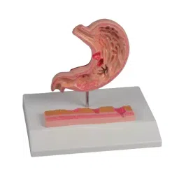 AS ONE Gastric Ulcer Model 120×90×20 mm PVC Vinyl Chloride Resin, 8-8569-01-image-12