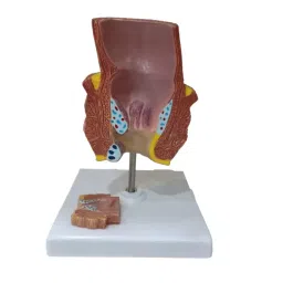 A-ONE SCIENCE Multicolor PVC Diseased Rectum Model AOSBM137-picture-42