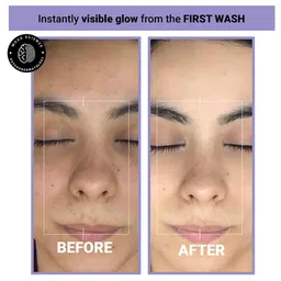 SEREKO Clarifying Face Cleanser with Vitamin C - 100 ml image 4