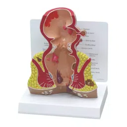A-ONE SCIENCE Multicolor PVC Hemorroids Model AOSBM138-image-96