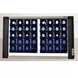 Skybound ZEDX Double Film Conventional X-Ray View Box 4U-SQZ2-8RDU-23