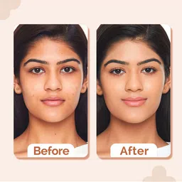 The Derma co. 2% Niacinamide High Coverage Foundation With SPF40 30ml - Peach 05 image 2