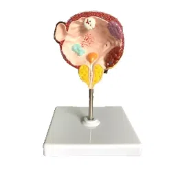 A-ONE SCIENCE Multicolor PVC Diseased Bladder And Prostate Gland Model AOSBM166-image-28