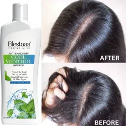 MENTHIL COOL Anti Dandruff Neem Shampoo | No Sls & Paraben | Hair Fall Control-4