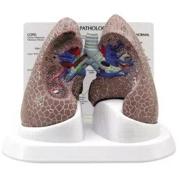 A-ONE SCIENCE Multicolor PVC Lung Disease Model AOSBM159-image-29
