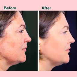 mountainor L Glutathione 1000mg for Healthy, Brightening & Radiant Skin. image 3