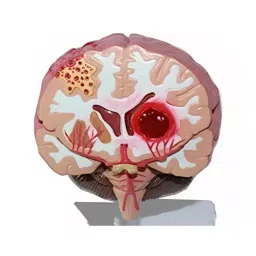 A-ONE SCIENCE Multicolor PVC Brain Stroke Model AOSBM152-image-30