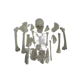 WKM 5 Ft Dis Articulated Human Skeleton Anatomical Model WKM KTBR307-image-15