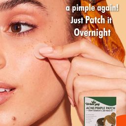 URBANYOG Face Care Combo Kit- Anti-Pigmentation Serum-30 ml & Acne Pimple Patch-72 Dots image 4