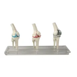 A-ONE SCIENCE White PVC 3 Stage Knee Arthritis With Implants AOSBM150-picture-38