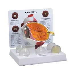 A-ONE SCIENCE Multicolor PVC Cataract Eye Model AOSBM80-image-49