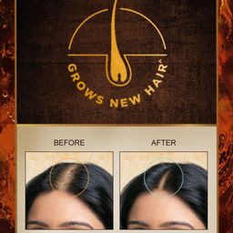 indulekha Bringha Hair Oil 250 ml image 2