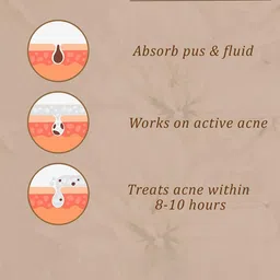 TRENDTREE Acne Pimple Patches For Face - 36 Patches image 4