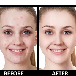 SHRYOAN Beige Colored Hydra-boost High Coverage Foundation image 3