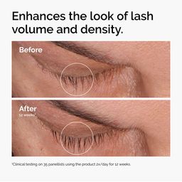 THE ORDINARY Multi-Peptide Lash and Brow Serum - 5ml image 2
