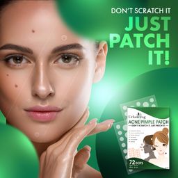 Urban Yog Acne Pimple Patch for Face (72 dots) | Waterproof Patches for Active Acne | Absorbs Pimple Overnight and Reduces Excess Oil | Facial Patches with 100% Hydrocolloid image 2