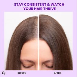 Carbamide Forte Biotin Tablets for Hair Growth with Amla, Brahmi & Bamboo Extract | Hair Growth Tablet | Hair Vitamins | Hair Supplements for Women & Men - 90 Veg Tablet image 5