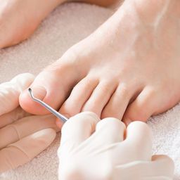 godsdwares 14Pcs Ingrown Toe Nail Remover, Ingrown Toenail Correction Tool Toenail C-pads Professional Ingrown Toenail Tool for Toenail Care Pain image 5