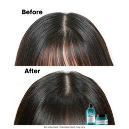 l'oréal professionnel paris L’Oréal Professionnel Scalp Advanced Anti-Oiliness Dermo-Purifier Shampoo 300ml | For Oily Scalps | Purifies the Scalp Deeply with 3% AHA | For Men & Women image 3