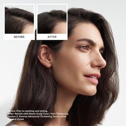 NIOXIN System 3 Scalp Activating Treatment, 3.4 Ounce image 3