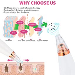 quiqshipp 6 in 1 Multi-function Blackhead Remover Tools | Electric Derma suction Machine | USB Rechargeable Acne Pimple Pore Cleaner Vacuum tool - Facial Cleanser Device for Nose & Skin Care (White) image 4