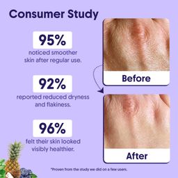 Aravi Organic 10% AHA + 1% BHA Body Lotion For Exfoliation - Treats Strawberry Legs & Bumpy Skin With Ceramide - Skin Britheninig Lotion With Niacinamide and Shea Butter - 200 ml image 4