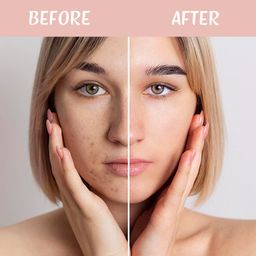 bellacast Hydrating BB Cream, gives Light Make up Glow, Lightweight and Full Coverage, Seashell Pink, 30 ml image 4