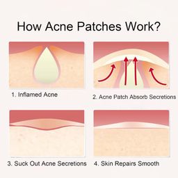 keli Pimple Patch Hydrocolloid, Pimple Patches, 36 Acne Patches, Acne Plaster, Pimple Acne Patch Plaster in Two Sizes: 24 x 12 mm Diameter and 48 x 0.8 mm Diameter image 4