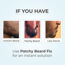 rise for men Patchy Beard Fix : Apply In One Minute | Natural Look | Smudge & Water Proof | No Side Effects image 2