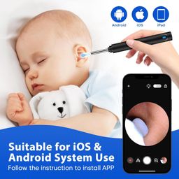 AARUX Ear Wax Removal Tool with 1080P HD Camera, Smart Visual Otoscope Cleaner Kit 6 Replaceable Tips, WiFi Scope for iPhone, Android, and Tablets Camera, Safe Earwax Remover Tips & LED Light image 5