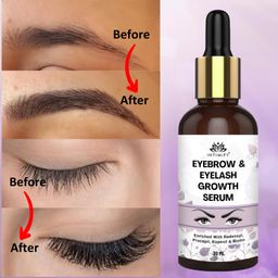 INTIMIFY EyeBrow & EyeLash Growth Serum 30 ml (Pack of 1) image 3