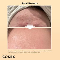 Cosrx Advanced Snail 96 Mucin Power Essence (100ml) image 2