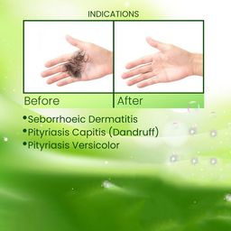 Adonis Grip Hair KT Shampoo For Dandruff - 100 ml image 5