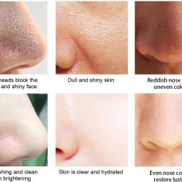 Paper Blackhead Remover Strips-image-6