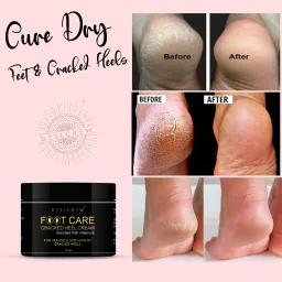 Feet Crack Heel Repair Cream Smooth Foot Crack Cracked Heel Repair Foot Cream-image-33