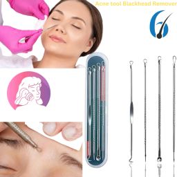 Stainless Steel Blackhead Remover Needle-image-58