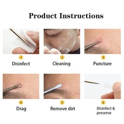 MAJESTIQUE Set of Blackhead & Pimple Remover Kit - Magnifying Mirror - Cotton Pads image 4