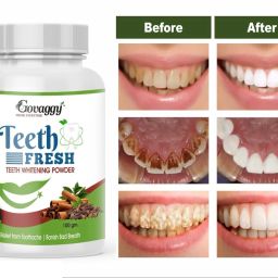 Best NATURAL 2X Stain Removal Teeth Whitening Kit-image-56