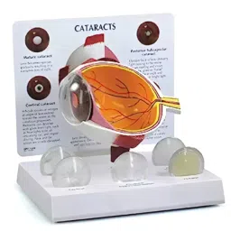 A-ONE SCIENCE Multicolor PVC Human Cataract Eye Model AOSBM161-image-93