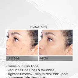 Adonis Adrito Face Serum With Niacinamide For Dark Spot - 50 ml image 5