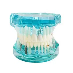 A-ONE SCIENCE White and Blue PVC Transperant Dental Implantation Tooth Model AOSBM130-30