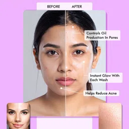 NUATRAFOL Salicylic Acid Face Wash With Oat Extract - 50 ml image 4